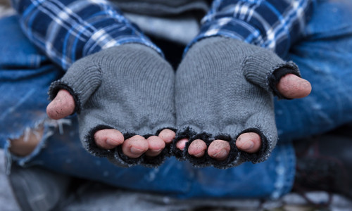 Close-up Of A Beggar's Dirty Fingers