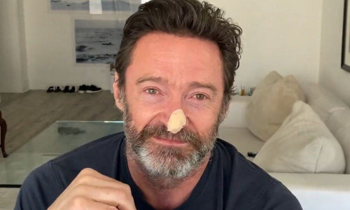 hugh jackman