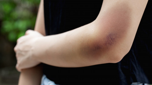O minoră a fost lovită cu pumnii şi picioarele de trei fete/ Shutterstock