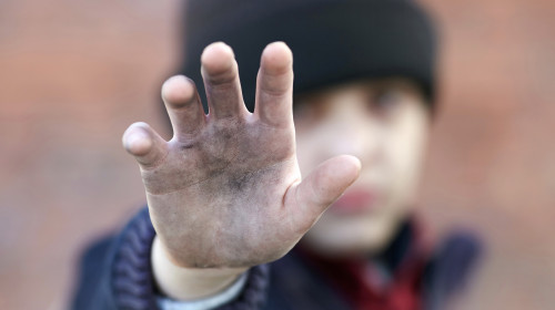 Dramatic,Portrait,Of,A,Little,Homeless,Boy,,Dirty,Hand,,Poverty,