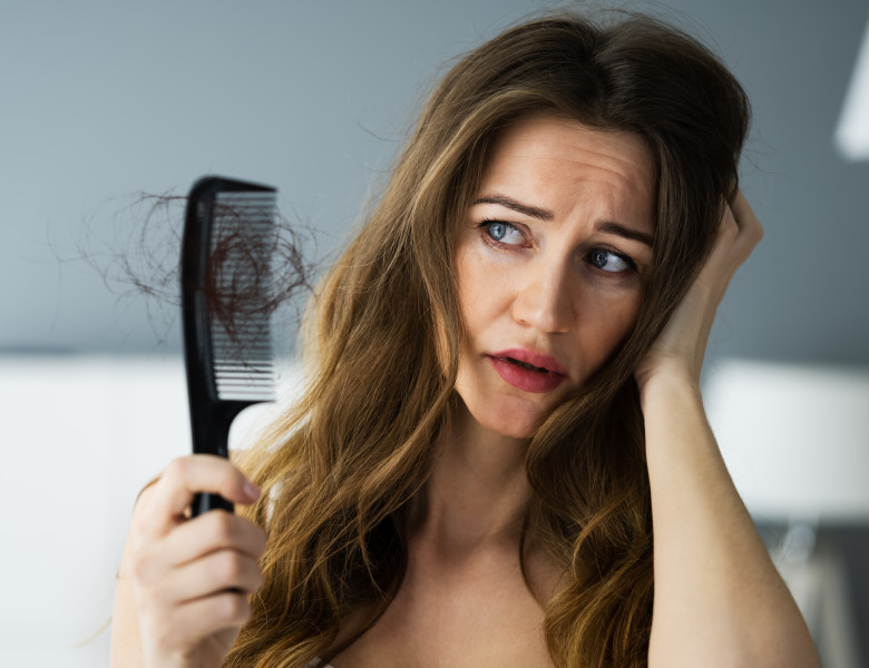 Woman,Suffering,From,Hairloss,Or,Hairfall,Problem
