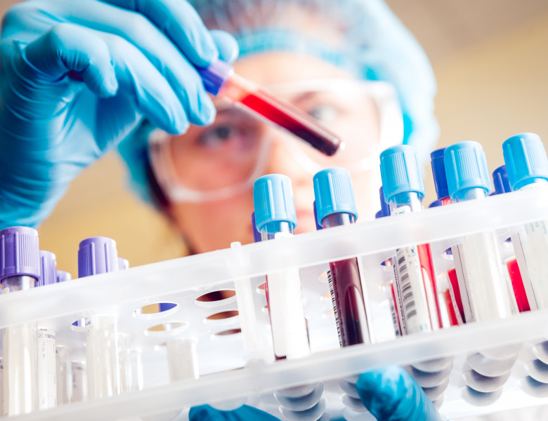 Au fost descoperite microparticule de plastic în sângele uman/ Shutterstock