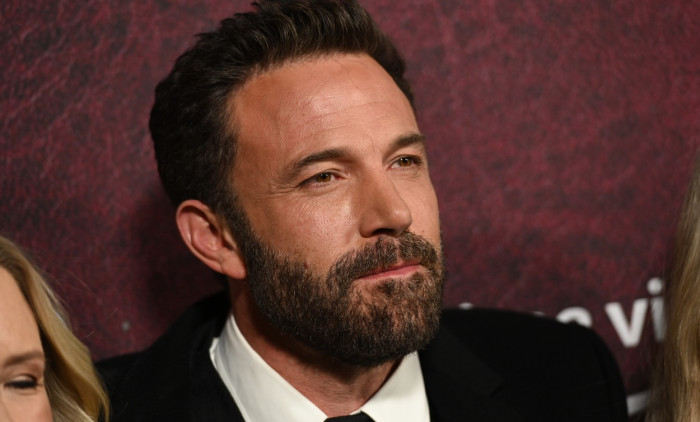 Ben Affleck a trebuit să-și repare dinții și să fie șarmant pentru un rol/  Profimedia