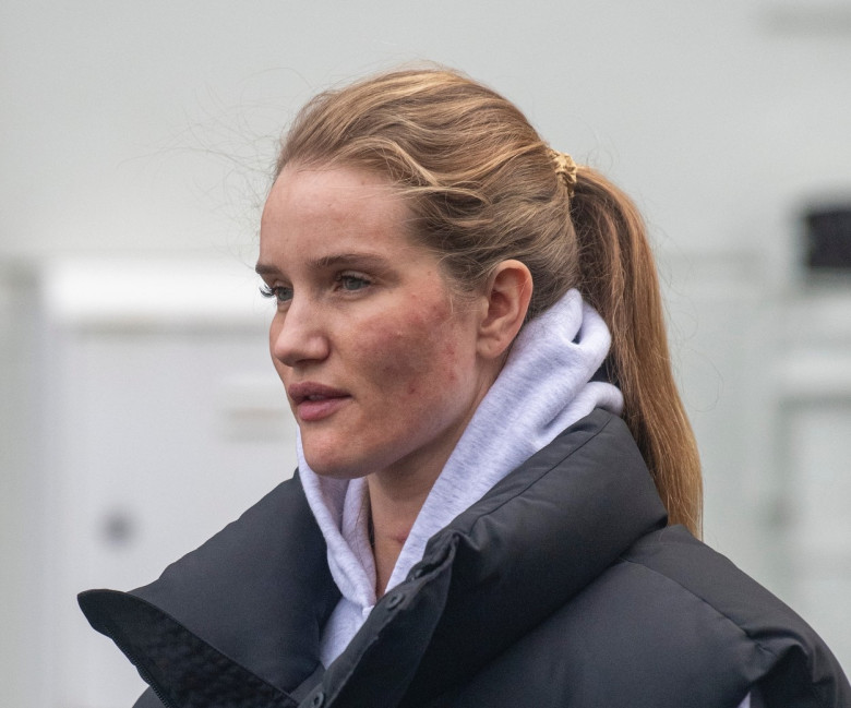 *EXCLUSIVE* *STRICTLY NO SUBSCRIPTIONS AND NO SOCIAL SOCIAL MEDIA USE* Rosie Huntington Whiteley steps out in London with a large scar on her neck.