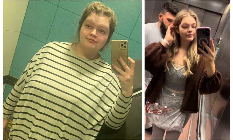 Transformarea spectaculoasă a unei tinere care a slăbit 70 de kilograme2