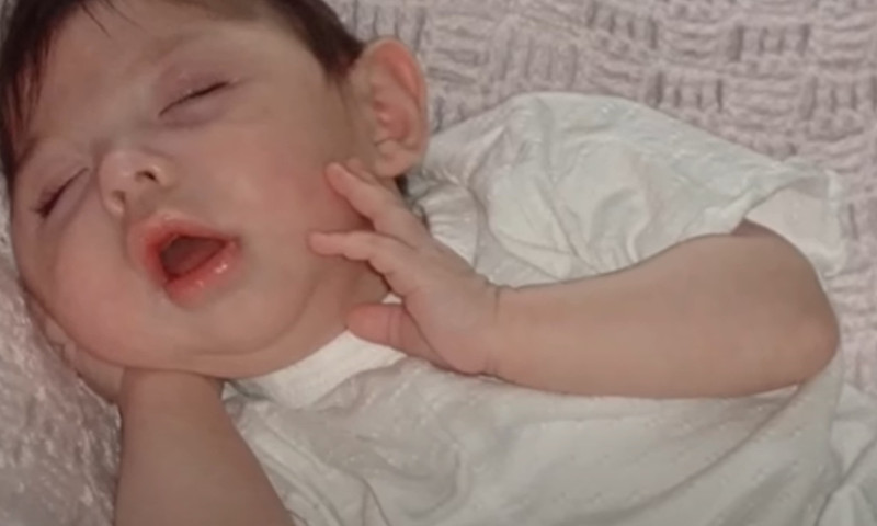 O tânără s-a născut fără creier