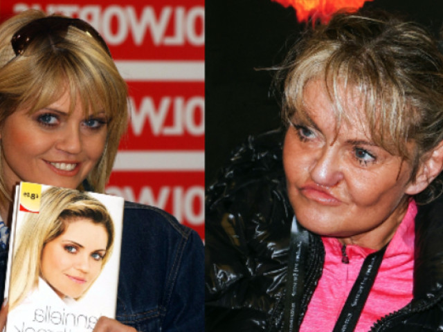 Coșmarul operațiilor pentru o actriță britanică. Încearcă să-și reconstruiască fața, după ani de vicii, excese și intervenții eșuate