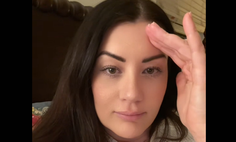 Ashley Warwick botox (5)