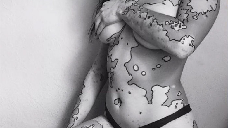 vitiligo-body-art-map-ashley-soto-22