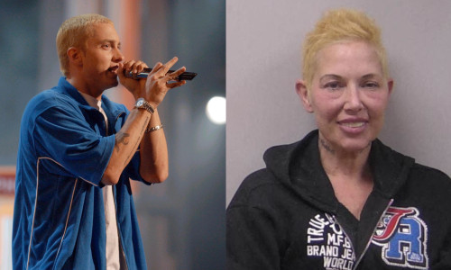 Fosta soție a lui Eminem, transportată de urgență la spital/ Profimedia