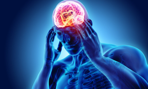 3d illustration of headache human.