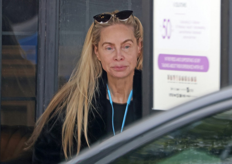 *PREMIUM-EXCLUSIVE* Christina Fulton continues her recovery after son Weston Cage allegedly attacked her at her home ealier in the month, as a detective vehicle is seen leaving her apartment