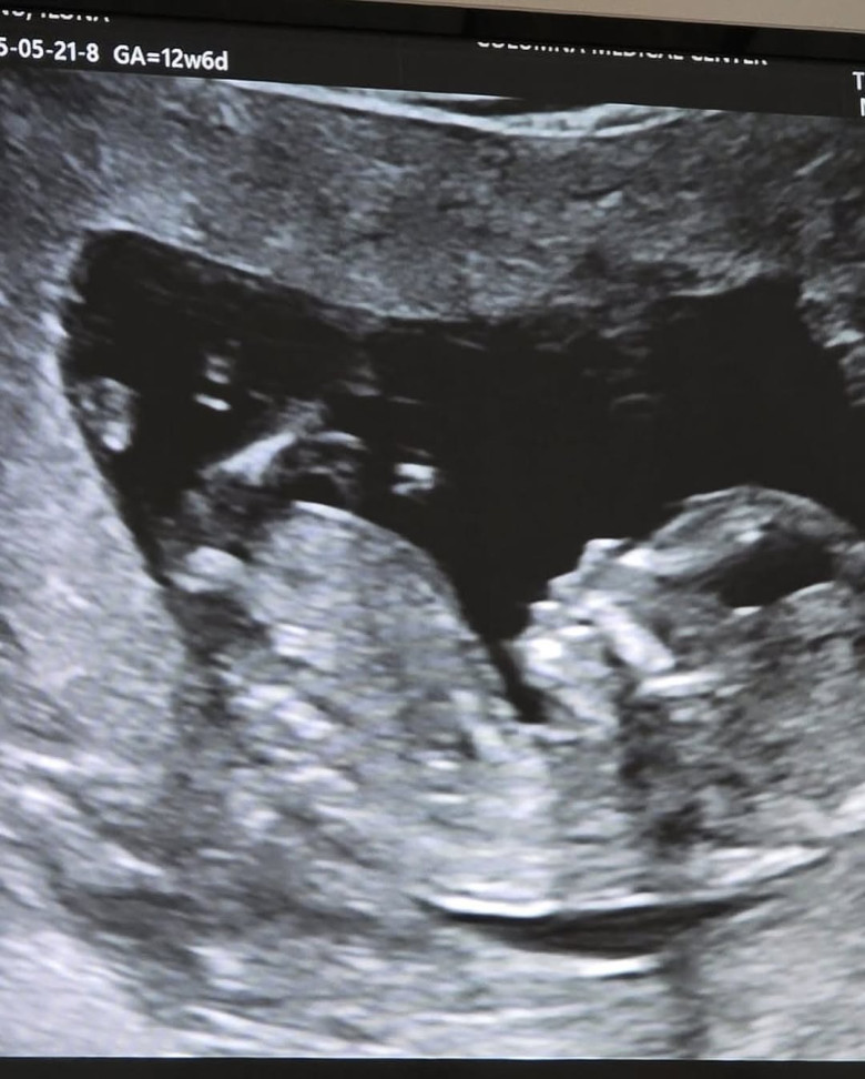 ilona-brezoianu-andrei-copil (4)