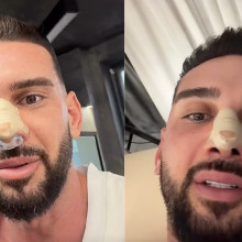 Dorian Popa și-a dat jos bandajele la 12 zile de la operația la nas. Cum arată acum și ce spune despre recuperare