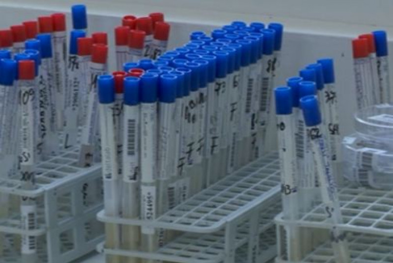 flacoane sange test hiv