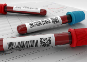 Un nou test de sânge, rezultate promițătoare în depistarea precoce a șase tipuri de cancer. Ce se analizează prin biopsia lichidă
