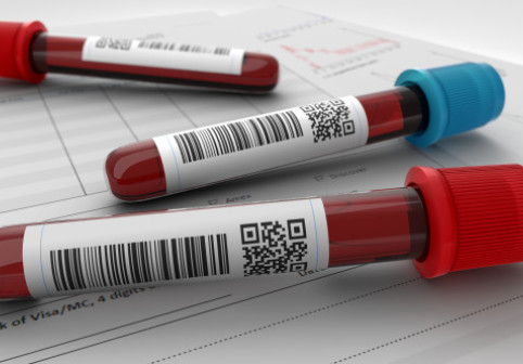 Un nou test de sânge, rezultate promițătoare în depistarea precoce a șase tipuri de cancer. Ce se analizează prin biopsia lichidă