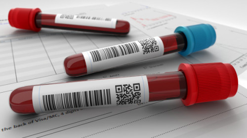 Un nou test de sânge, rezultate promițătoare în depistarea precoce a șase tipuri de cancer. Ce se analizează prin biopsia lichidă