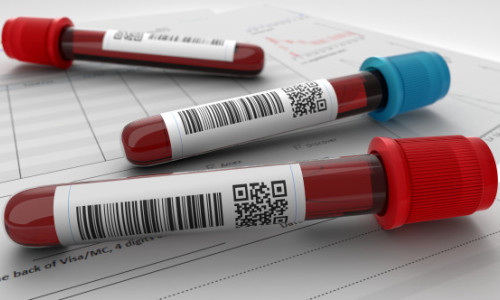Un nou test de sânge, rezultate promițătoare în depistarea precoce a șase tipuri de cancer. Ce se analizează prin biopsia lichidă