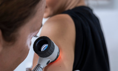 A crezut toată viața că are un semn din naștere pe piele, dar s-a dovedit a fi cancer. Cum a descoperit asta