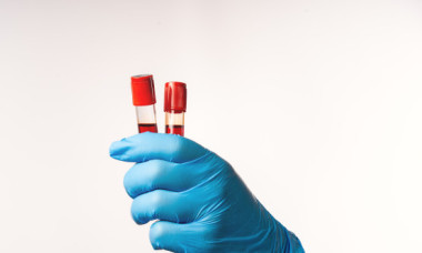 Pericol ascuns în băuturile energizante. Un ingredient folosit frecvent, asociat cu un risc crescut de cancer de sânge
