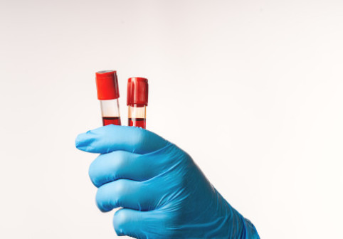 Pericol ascuns în băuturile energizante. Un ingredient folosit frecvent, asociat cu un risc crescut de cancer de sânge
