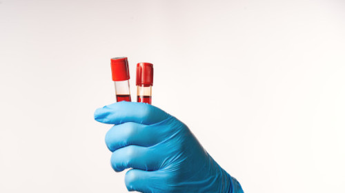 Pericol ascuns în băuturile energizante. Un ingredient folosit frecvent, asociat cu un risc crescut de cancer de sânge
