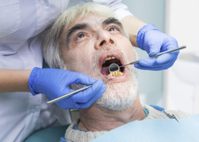 Ce spune culoarea dinților despre sănătatea ta, potrivit științei: "Dantura poate dezvălui ceea ce corpul nu spune încă"