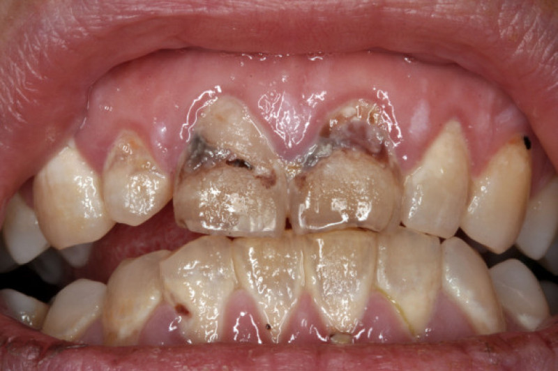 probleme dentare (2)