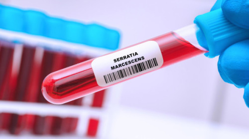 Ce este Serratia marcescens, bacteria care a dus la moartea a șase copii internați la Iași. Cum se transmite și cine este cel mai expus