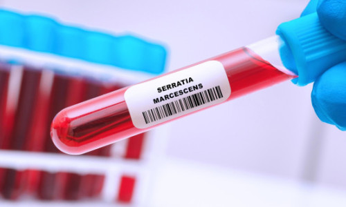 Ce este Serratia marcescens, bacteria care a dus la moartea a șase copii internați la Iași. Cum se transmite și cine este cel mai expus