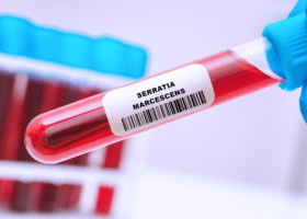 Ce este Serratia marcescens, bacteria care a dus la moartea a șase copii internați la Iași. Cum se transmite și cine este cel mai expus