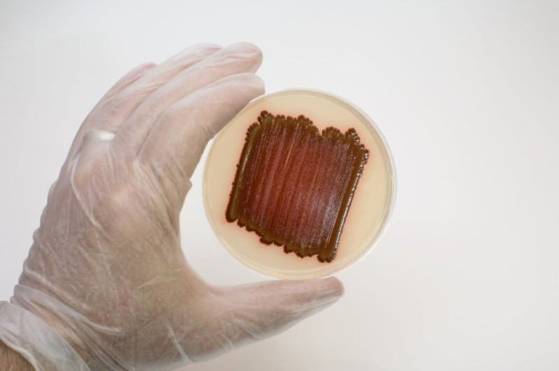 Serratia marcescens
