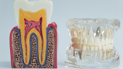 Cum îi afectează fumatul pe oamenii care-și fac implanturi dentare. Și cei cu dinți naturali au de suferit