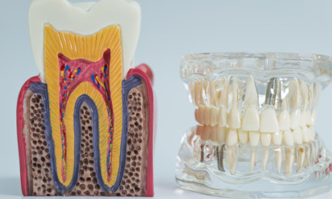 Cum îi afectează fumatul pe oamenii care-și fac implanturi dentare. Și cei cu dinți naturali au de suferit