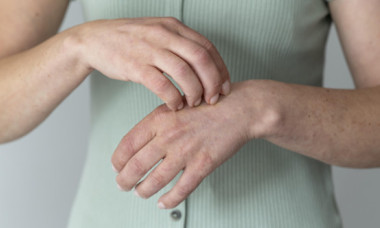 Ce este lepra, cum se transmite și cât de mare este, de fapt, pericolul. Un caz de lepră a fost confirmat în Cluj-Napoca