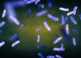 Ce trebuie să știi despre tratamentul leprei. Medic infecționist: „Poate dura și până la doi ani!” Două cazuri au fost confirmate la Cluj