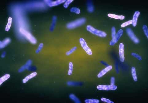 Ce trebuie să știi despre tratamentul leprei. Medic infecționist: „Poate dura și până la doi ani!” Două cazuri au fost confirmate la Cluj