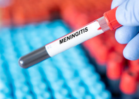 Simptomele meningitei care te pot păcăli. 7 boli comune confundate cu infecția mortală care face ravagii în Marea Britanie