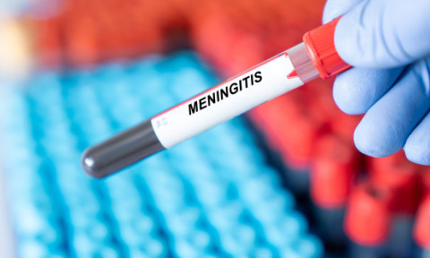 Simptomele meningitei care te pot păcăli. 7 boli comune confundate cu infecția mortală care face ravagii în Marea Britanie