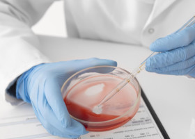 Ce este hemocromatoza, boală genetică supranumită "blestemul celtic". Simptomele afecțiunii, uneori evidente după zeci de ani