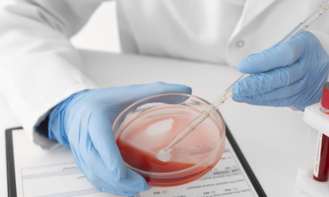 Ce este hemocromatoza, boală genetică supranumită "blestemul celtic". Simptomele afecțiunii, uneori evidente după zeci de ani