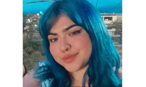 La un pas de moarte din cauza cercelului din nas. Cazul bizar al unei tinere: 