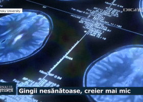 Legătura neașteptată dintre gingii și creier. Boala gingivală poate accelera îmbătrânirea unei zone esențiale