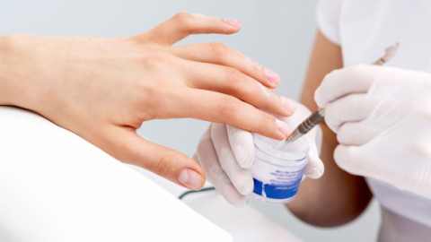4 semne de glicemie mare care pot apărea la unghii. Medicii spun când e cazul să te îngrijorezi