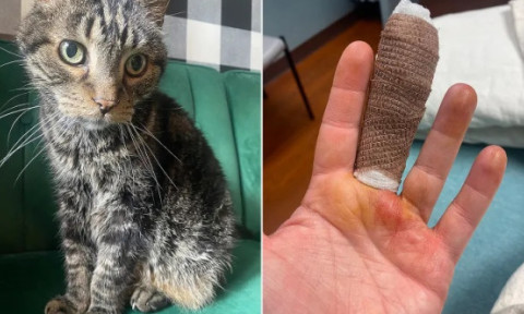 O simplă zgârietură de pisică i-a schimbat viața unei femei. A fost internată în spital și s-a luptat zile întregi cu infecția