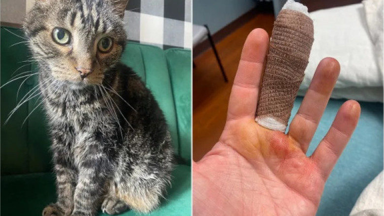 O simplă zgârietură de pisică i-a schimbat viața unei femei. A fost internată în spital și s-a luptat zile întregi cu infecția
