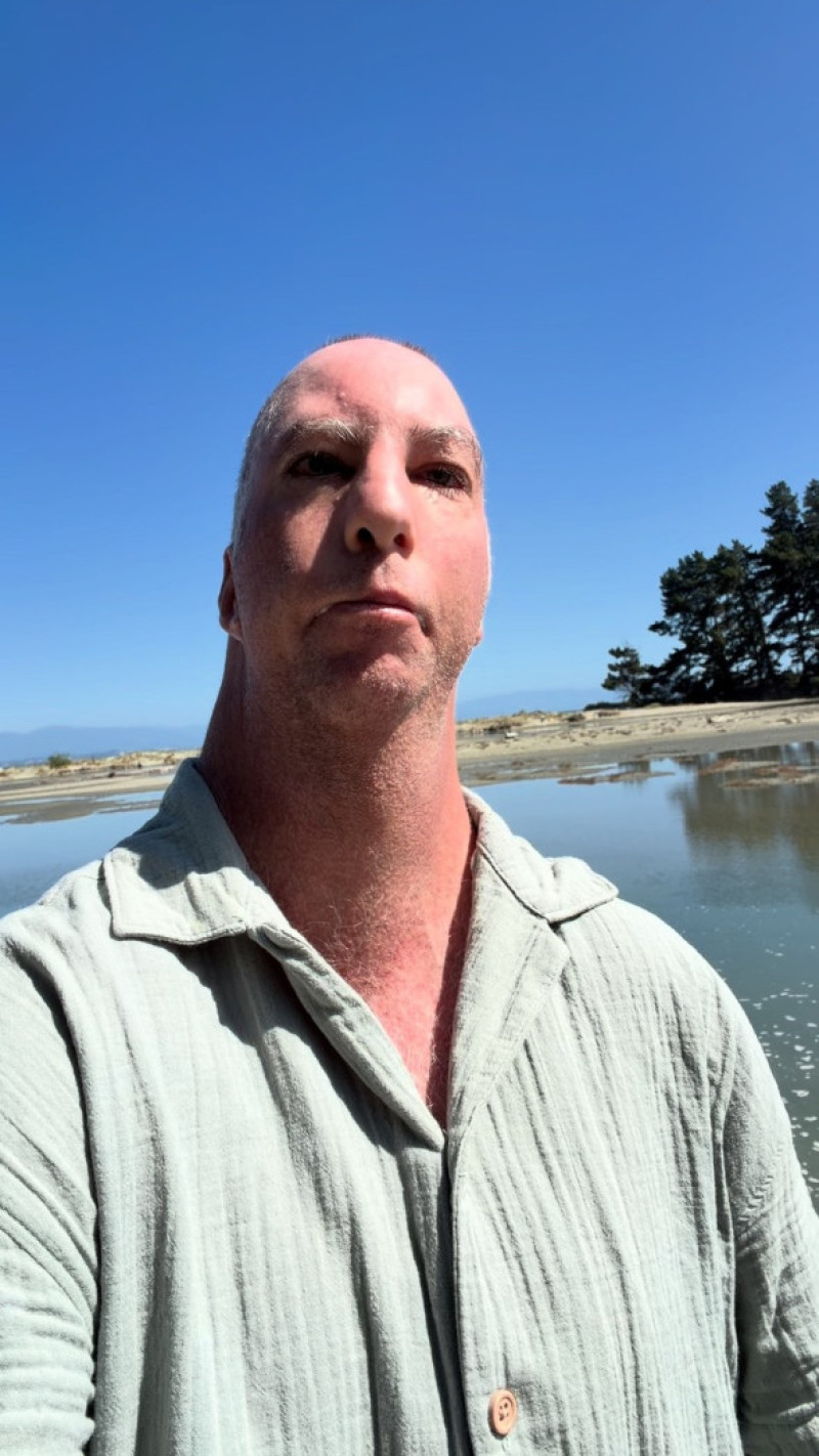 Influencer with 'Birdman syndome' who beat the odds reveals doctors said he 'wouldn't live past 24 hours'