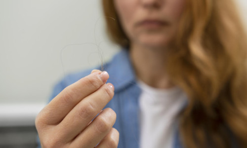 Un compus natural ar putea îmbunătăţi eficienţa tratamentelor pentru căderea părului