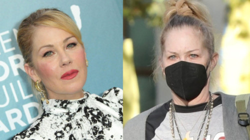 "Cel mai rău lucru pe care l-am trăit în viața mea". Christina Applegate, dată cu totul peste cap de problemele grave de sănătate